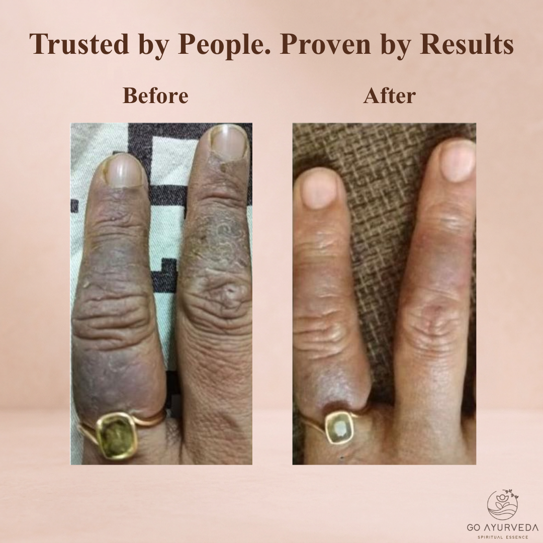 Go Ayurveda Dhanvantri