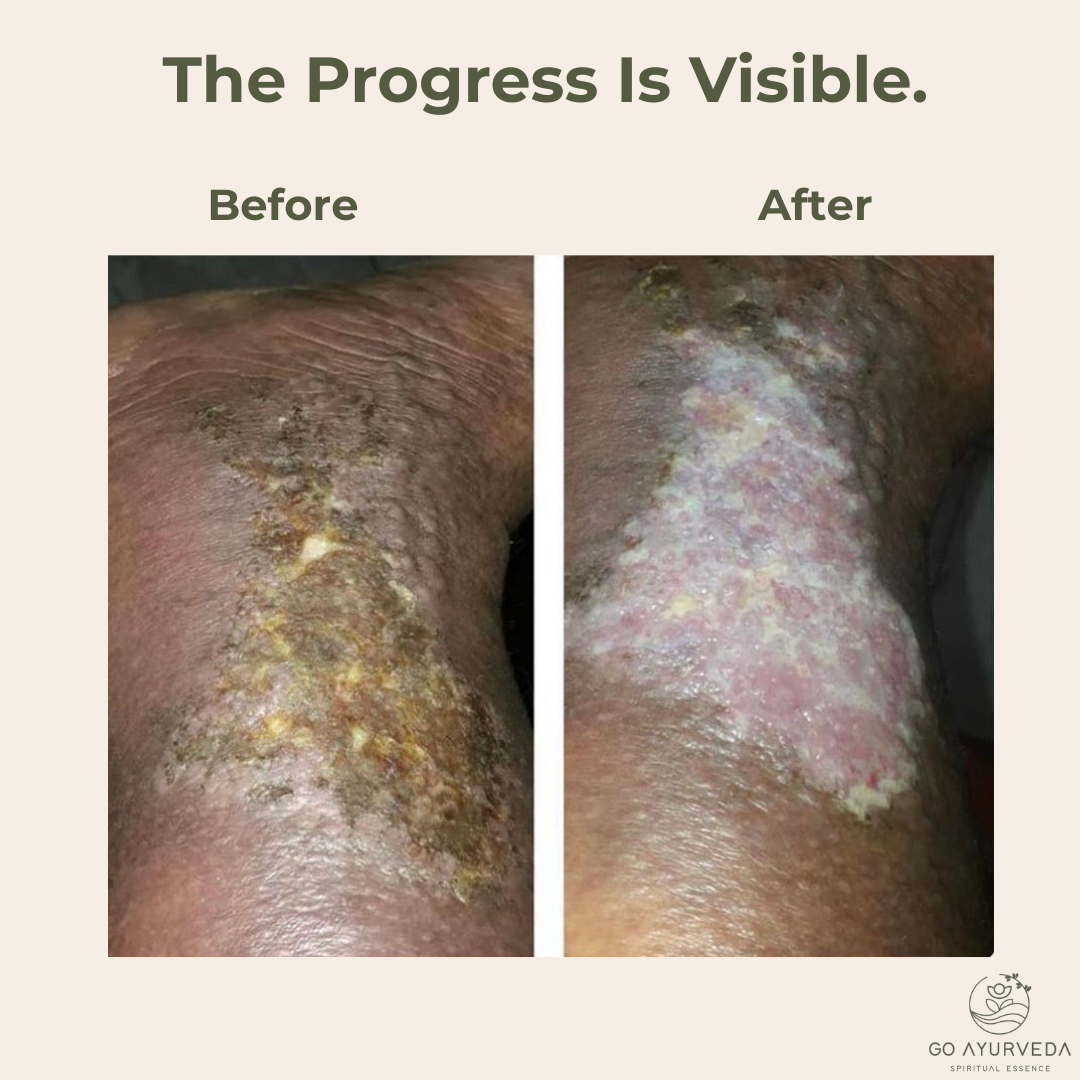 Go Ayurveda Dhanvantri