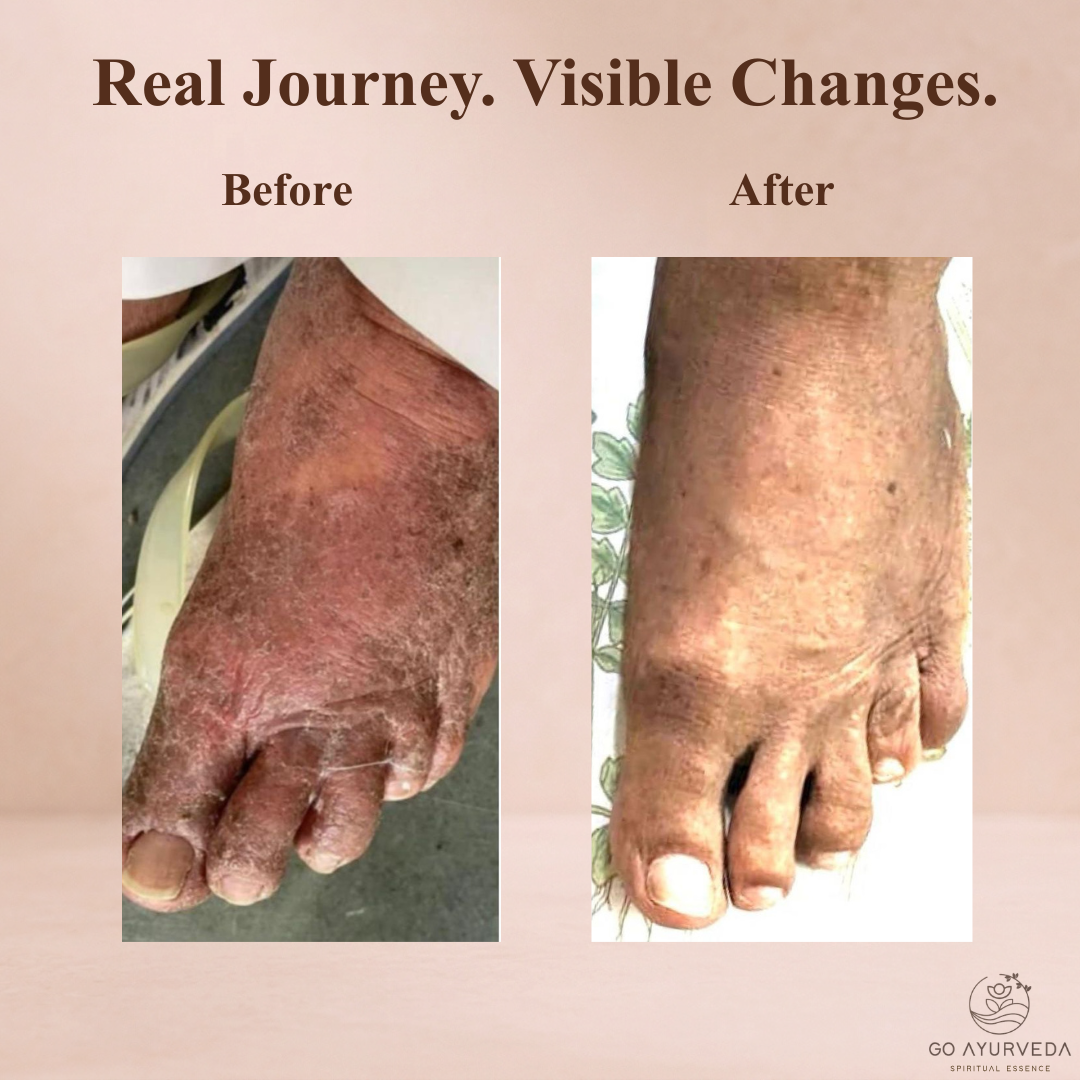 Go Ayurveda Dhanvantri
