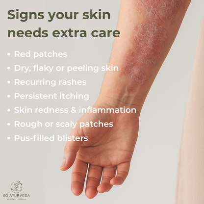 Derm Care Oil Roll-On - Ayurvedic Oil for Psoriasis, Eczema, Itching & Rashes